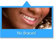 this is Braces