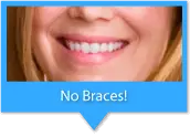 this is Braces