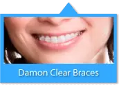 this is Braces