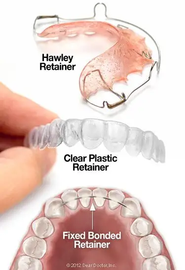 Retainers image